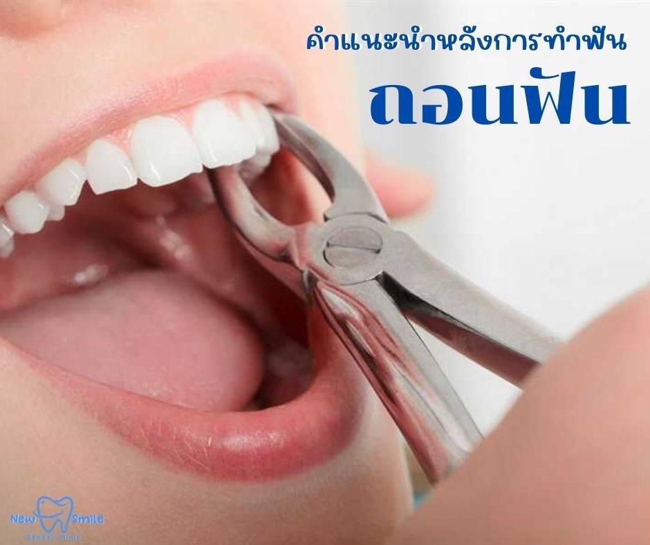 ทันตแพทย์  คลินิก หาดใหญ่    จัดฟัน ดัดฟัน หมอฟัน  ปรึกษา ทำฟัน