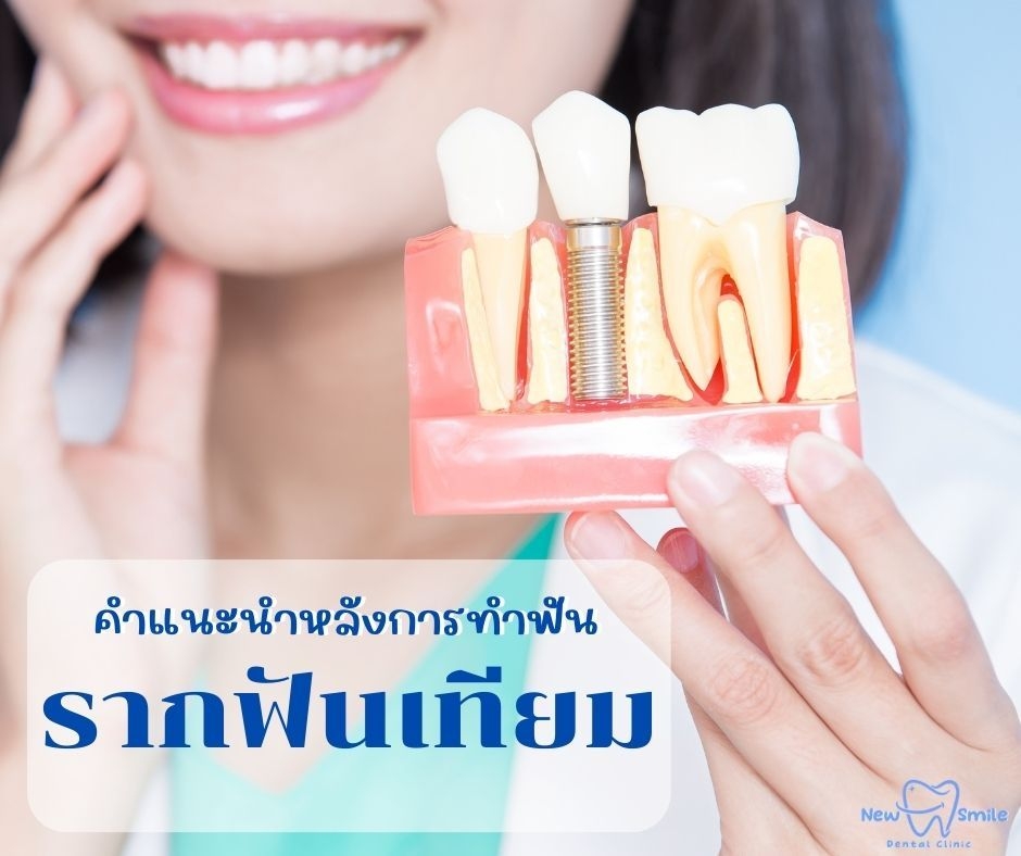 การให้คำแนะนำหลังการทำฟัน รากฟันเทียม